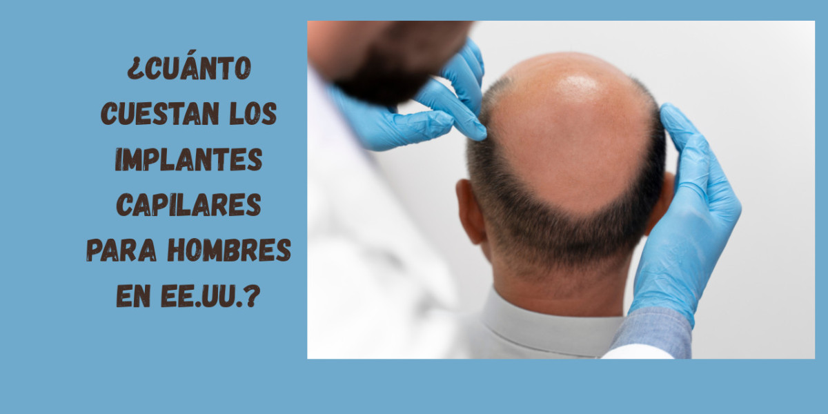 ¿Cuánto Cuestan los Implantes Capilares para Hombres en EE.UU.?