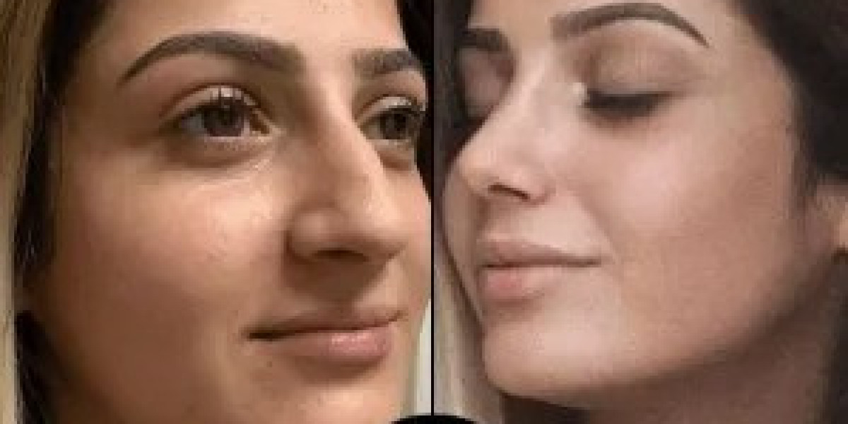 Best Plastic Surgeons in Dubai for Facelifts and Anti-Aging Solutions