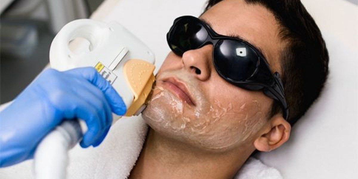 Laser Hair Removal in Islamabad: A Step Toward Holistic Wellness and Self-Care