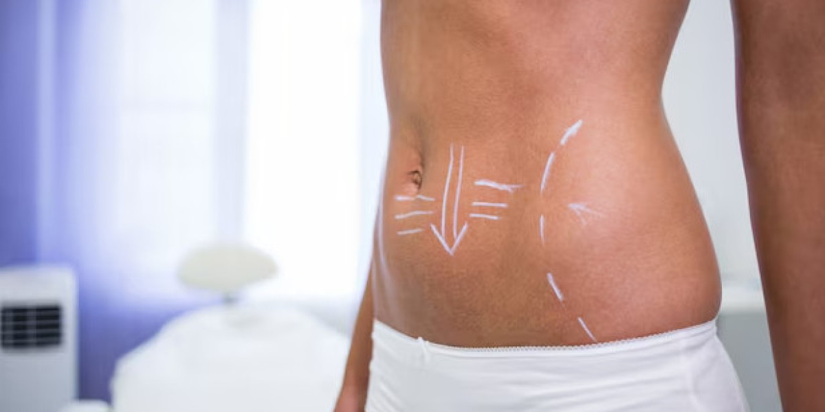 Transform Your Fitness Routine with Ems Muscle Toning Sessions Today