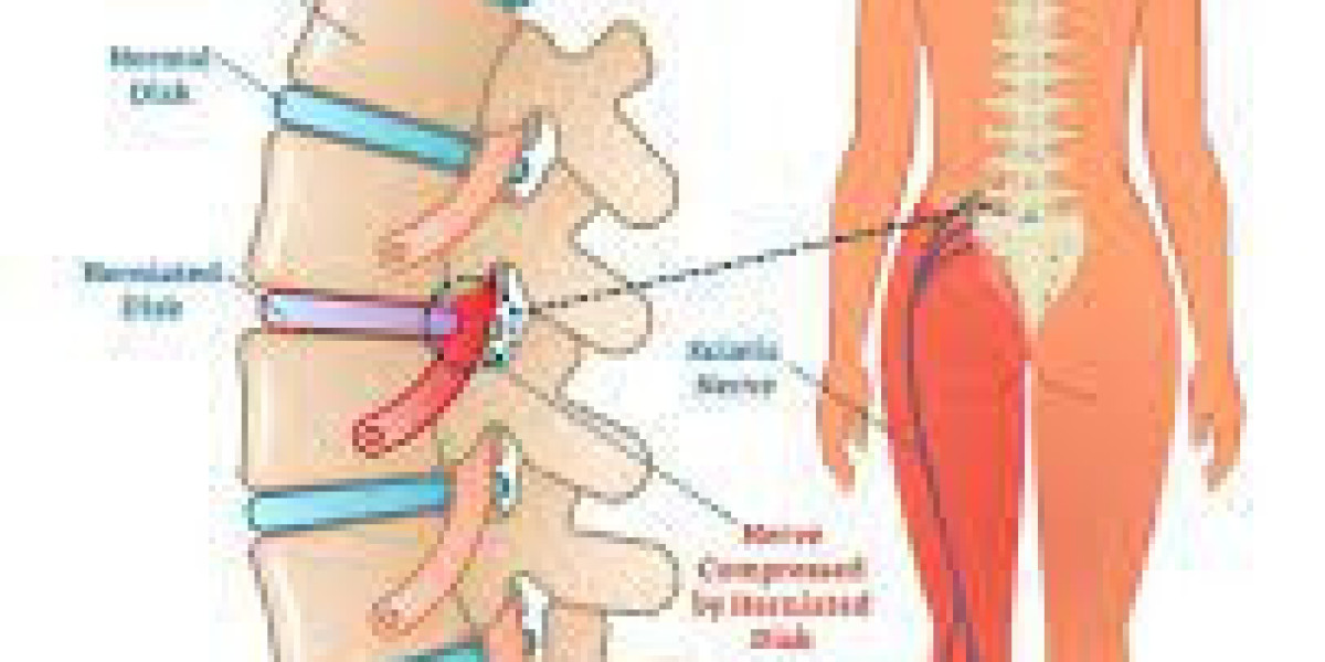 Maxgalin 75 Explained: What Pregabalin 75 mg Is Prescribed For (US Guide)