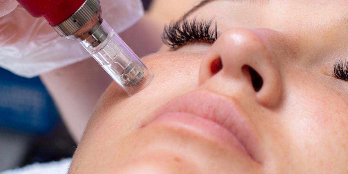 The Complete Guide to Dermaplaning in Frisco: Benefits, Procedure & Aftercare