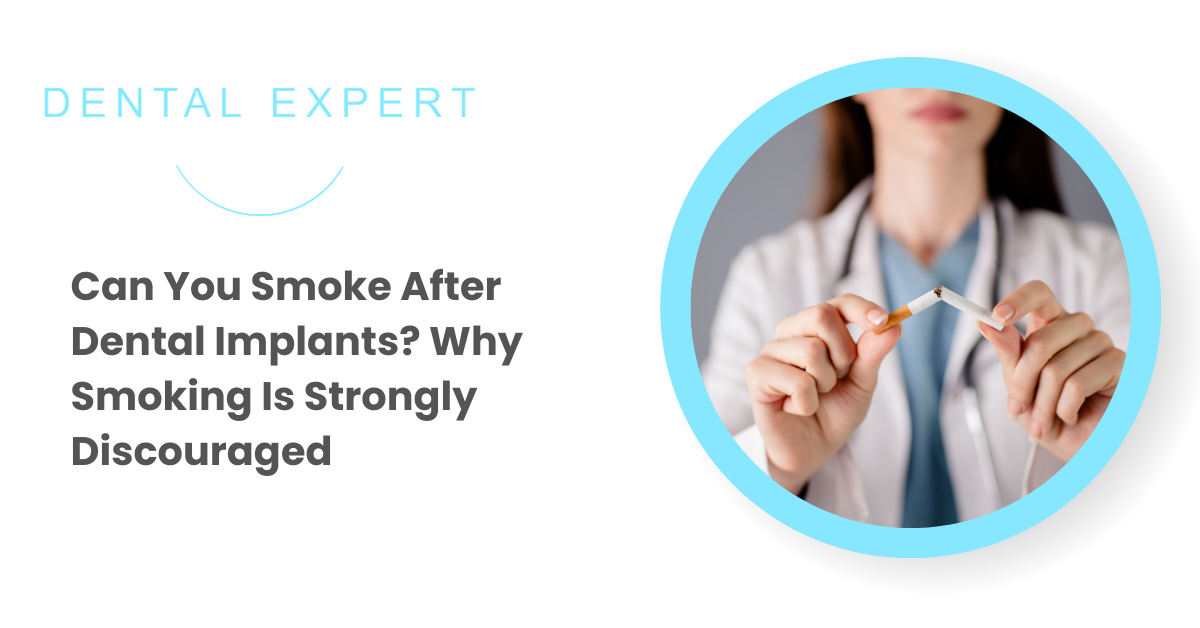 Why Smoking Can Harm Your Dental Implants | Dental Expert