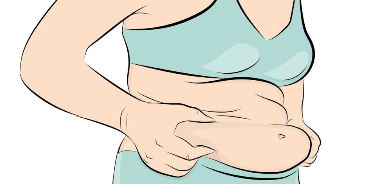 Abdominoplasty in Islamabad: Contour Your Abdomen with Precision