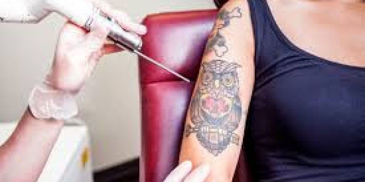 Top Clinics Offering Tattoo Removal in Islamabad